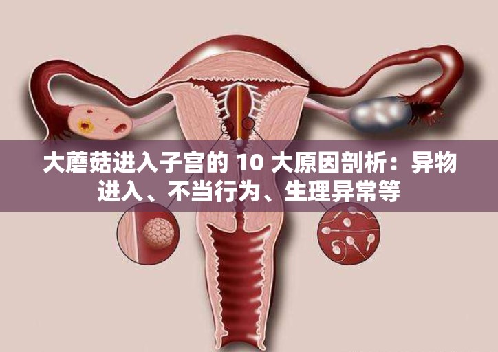 大蘑菇进入子宫的 10 大原因剖析：异物进入、不当行为、生理异常等