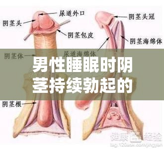 男性睡眠时阴茎持续勃起的原因是什么