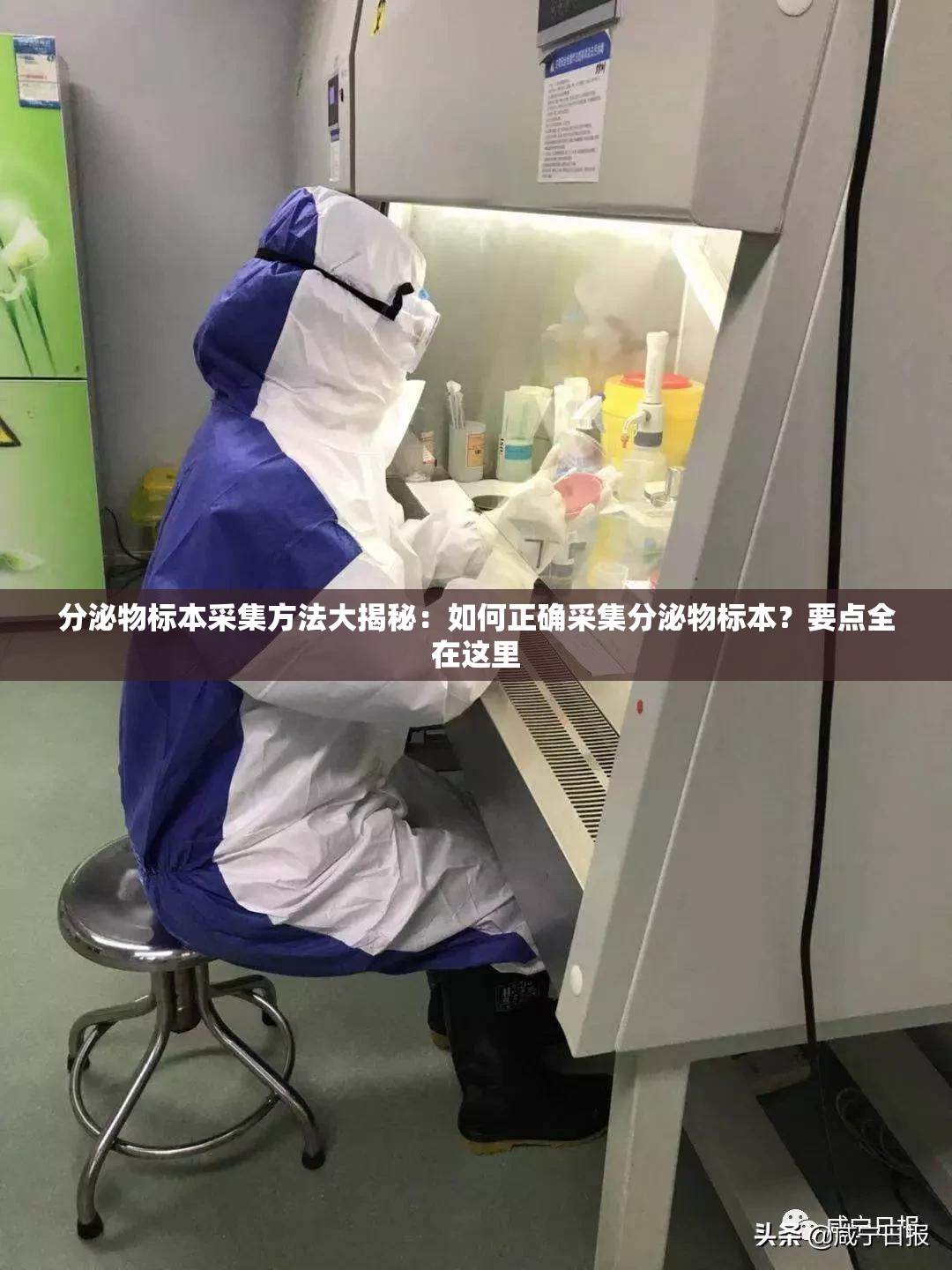 分泌物标本采集方法大揭秘：如何正确采集分泌物标本？要点全在这里
